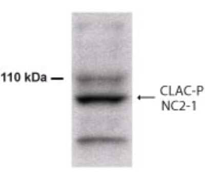 Western Blot: Collagen XXV Antibody [NB300-249] - Analysis of Collagen XXV, using Img-4153 and IMG-4154 at 1:500 dilution on 100 ug of formic acid extracts of Alzheimer diseased brain.