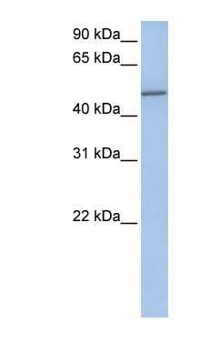 Western Blot: Collagen XXV Antibody [NBP1-60039] - Jurkat cell lysate, concentration 0.2-1 ug/ml.