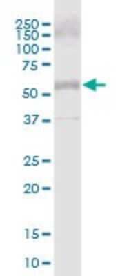 Western Blot: Collagen XXV alpha 1 Antibody [H00084570-B01P] - Analysis of COL25A1 expression in human placenta.