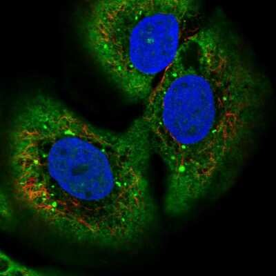 Immunocytochemistry/Immunofluorescence: Collectrin/TMEM27 Antibody [NBP2-13450] - Immunofluorescent staining of human cell line HaCaT shows localization to endoplasmic reticulum & vesicles.