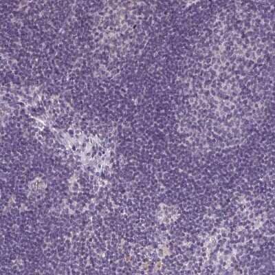 Immunohistochemistry-Paraffin: Collectrin/TMEM27 Antibody [NBP2-13450] - Staining of human lymph node shows low expression as expected.