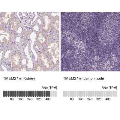 <b>Orthogonal Strategies Validation. </b>Immunohistochemistry-Paraffin: Collectrin/TMEM27 Antibody [NBP2-13450] - Staining in human kidney and lymph node tissues using anti-TMEM27 antibody. Corresponding TMEM27 RNA-seq data are presented for the same tissues.