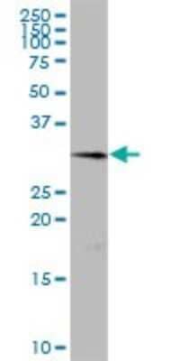 Western Blot: Collectrin/TMEM27 Antibody [H00057393-B01P] - Analysis of TMEM27 expression in human spleen.