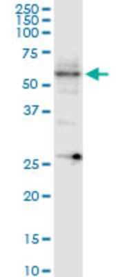 Western Blot: Collybistin/ARHGEF9 Antibody (3C11) [H00023229-M01] - ARHGEF9 monoclonal antibody (M01), clone 3C11. Analysis of ARHGEF9 expression in MCF-7.