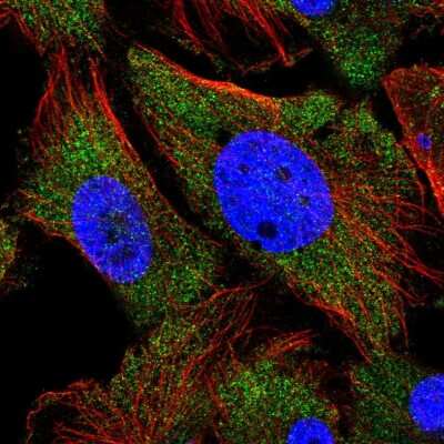 Immunocytochemistry/Immunofluorescence: Collybistin/ARHGEF9 Antibody [NBP2-58566] - Staining of human cell line U-251 MG shows localization to cytosol. Antibody staining is shown in green.