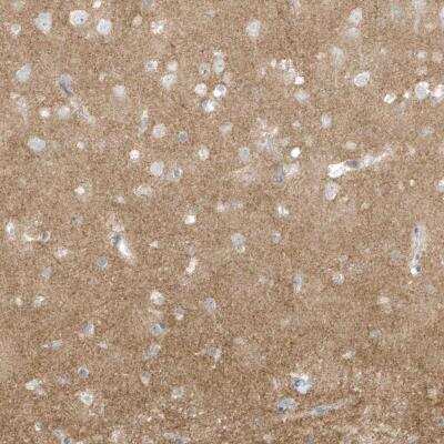 Immunohistochemistry-Paraffin: Collybistin/ARHGEF9 Antibody [NBP1-81509] - Staining of human cerebral cortex shows neuropil positivity.