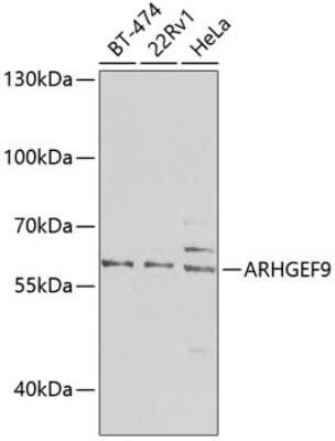 Western Blot: Collybistin/ARHGEF9 Antibody [NBP2-92919] - Analysis of extracts of various cell lines, using Collybistin/ARHGEF9 at 1:1000 dilution.Secondary antibody: HRP Goat Anti-Rabbit IgG (H+L) at 1:10000 dilution.Lysates/proteins: 25ug per lane.Blocking buffer: 3% nonfat dry milk in TBST.Detection: ECL Basic Kit .Exposure time: 90s.