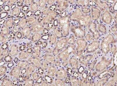 Colorectal Cancer Associated 1 Antibody [NBP3-05947] - Staining of human Colorectal Cancer Associated 1 in human kidney with rabbit polyclonal antibody at 1:100 dilution.