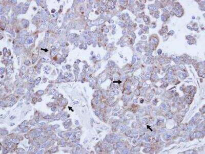 Immunohistochemistry-Paraffin: Common beta Chain Antibody [NBP1-31771] - Paraffin-embedded OVCAR3 xenograft, using antibody at 1:100 dilution.
