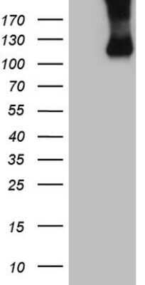 Western Blot: Common beta Chain Antibody (OTI4H3) - Azide and BSA Free [NBP2-70463] - Analysis of HEK293T cells were transfected with the pCMV6-ENTRY control (Left lane) or pCMV6-ENTRY Common beta Chain.