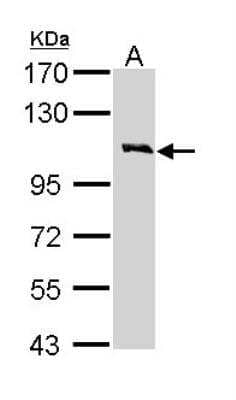 Western Blot: Common beta Chain Antibody [NBP1-31771] - Sample (30 ug of whole cell lysate) A: H1299 7. 5% SDS PAGE; antibody diluted at 1:1000.