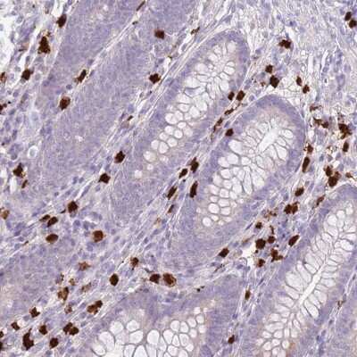 Immunohistochemistry-Paraffin: Common gamma Chain/IL-2 R gamma Antibody [NBP2-14122] - Staining of human appendix shows high expression.