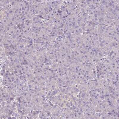 Immunohistochemistry-Paraffin: Common gamma Chain/IL-2 R gamma Antibody [NBP2-14122] - Staining of human pancreas shows low expression as expected.