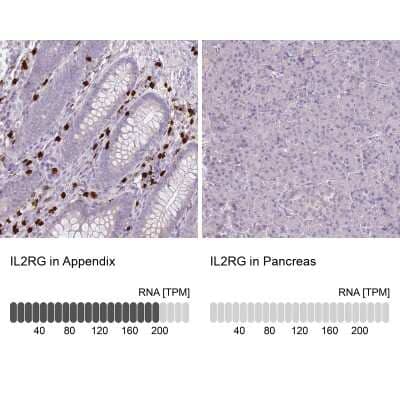 Immunohistochemistry-Paraffin: Common gamma Chain/IL-2 R gamma Antibody [NBP2-14122] - Staining in human appendix and pancreas tissues using anti-IL2RG antibody. Corresponding IL2RG RNA-seq data are presented for the same tissues.