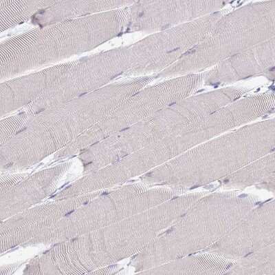 Immunohistochemistry-Paraffin: Common gamma Chain/IL-2 R gamma Antibody [NBP2-14122] - Staining of human skeletal muscle shows no positivity in myocytes as expected.