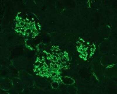 Immunocytochemistry/Immunofluorescence: Complement C3 Antibody (11H9) - Azide and BSA Free [NBP2-80677] - C3 protein fragments deposited on kidney cells of MPL-lpr mouse. Staining with antibody 11H9. Glomerular staining pattern. Fixation in 4% paraformaldehyde in PBS pH 7.4. Vibratome sections of 4 um. Pretreated with 3% hydrogen peroxide for 20 min to quench endogenous peroxidases. Microwaved in antigen unmasking solution for 2-5 minutes as antigen retrieval. Image from the standard format of this antibody.