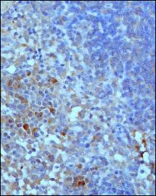 Immunocytochemistry: Complement C3 Antibody (11H9) - Azide and BSA Free [NBP2-80677] - Complement C3 protein in a FFPE tissue section of mouse lymph node using 1:100 dilution of Complement C3 antibody (clone 11H9) NB200-540. This representative photomicrograph shows a membrane-cytoplasmic immunopositivity in non-germinal center cells.