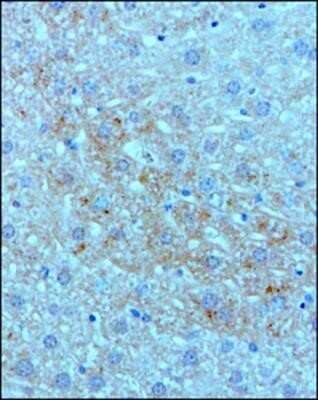 Immunohistochemistry: Complement C3 Antibody (11H9) - Azide and BSA Free [NBP2-80677] - Complement C3 protein in a FFPE tissue section of mouse liver using 1:100 dilution of Complement C3 antibody (clone 11H9) NB200-540. Weak but distinct membrane-cytoplasmic immunopositivity was observed in hepatocytes.