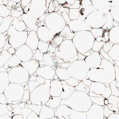 <b>Independent Antibodies Validation. </b>Immunohistochemistry-Paraffin: Complement C3 Antibody [NBP1-85492] - Staining of human adipose tissue shows moderate extracellular space positivity in adipocytes.