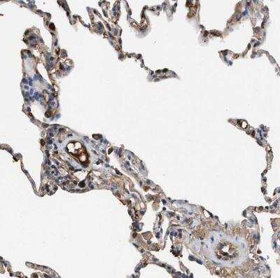 Immunohistochemistry-Paraffin: Complement C3 Antibody [NBP1-85492] - Staining of human lung shows strong extracellular space positivity in macrophages.