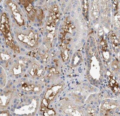 Immunohistochemistry-Paraffin: Complement C3 Antibody [NBP1-85492] - Staining of human kidney shows strong extracellular space positivity in cells in tubules.