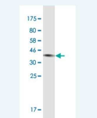 Western Blot: Complement C3 Antibody (X1) [H00000718-M11-100ug] - Detection against Immunogen (37.95 kDa).