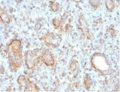 Immunohistochemistry-Paraffin: Complement C3d Antibody (C3D/2891) - Azide and BSA Free [NBP3-08764] - Formalin-fixed, paraffin-embedded human rejected kidney transplant stained with Complement C3d Antibody (C3D/2891) at 2ug/ml in PBS. HIER: Tris/EDTA, pH9.0, 45min. HRP-polymer, 30min. DAB, 5min.