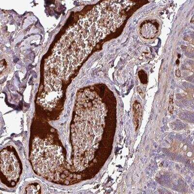 Immunohistochemistry: Complement C4a Antibody [NBP2-46783] - Staining of human duodenum shows positivity in plasma.