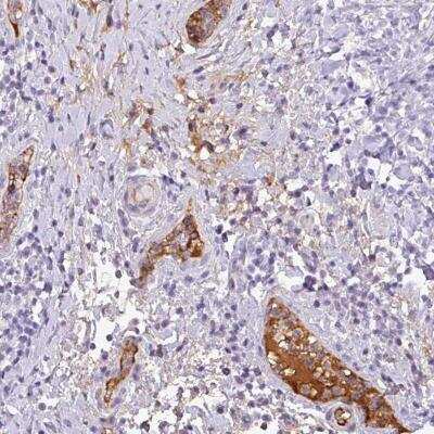 Immunohistochemistry-Paraffin: Complement C4a Antibody [NBP2-46723] - Staining of human urinary bladder shows positivity in plasma.