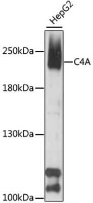 Western Blot: Complement C4a Antibody [NBP3-05665] - Western blot analysis of extracts of HepG2 cells, using Complement C4a antibody (NBP3-05665) at 1:1000 dilution. Secondary antibody: HRP Goat Anti-Rabbit IgG (H+L) at 1:10000 dilution. Lysates/proteins: 25ug per lane. Blocking buffer: 3% nonfat dry milk in TBST. Detection: ECL Basic Kit. Exposure time: 90s.
