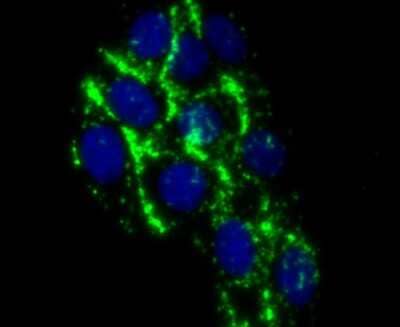 Immunocytochemistry/Immunofluorescence: Complement C4a/b Antibody (JM88-13) [NBP2-66995] - Staining C4 in HepG2 cells (green). The nuclear counter stain is DAPI (blue). Cells were fixed in paraformaldehyde, permeabilised with 0.25% Triton X100/PBS.