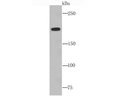 Western Blot: Complement C4a/b Antibody (JM88-13) [NBP2-66995] - Analysis of C4 on human liver tissue lysate using anti-C4 antibody at 1/1,000 dilution.