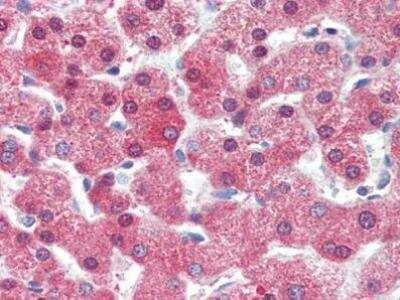Immunohistochemistry-Paraffin: Complement C4b Antibody [NBP1-50503] - C4b Antibody [NBP1-50503] - Staining of human liver. Immunohistochemistry of formalin-fixed, paraffin-embedded tissue after heat-induced antigen retrieval. Antibody concentration 10 ug/ml.