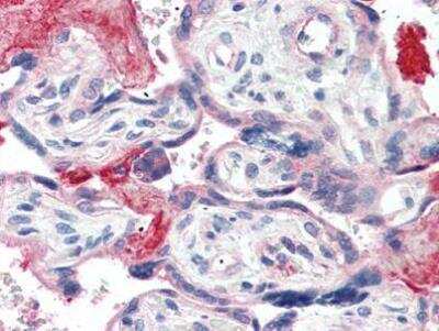 Immunohistochemistry-Paraffin: Complement C4b Antibody [NBP1-50503] - C4b Antibody [NBP1-50503] - Staining of human placenta. Immunohistochemistry of formalin-fixed, paraffin-embedded tissue after heat-induced antigen retrieval. Antibody concentration 10 ug/ml.