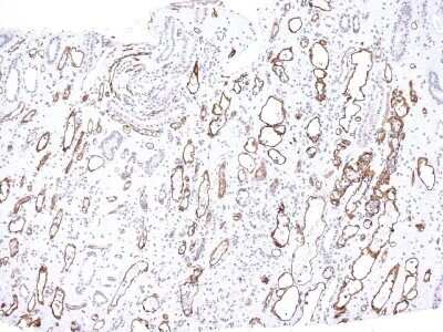 Immunohistochemistry-Paraffin: Complement C4b/d Antibody (C4D204) - Azide and BSA Free [NBP2-34581] - Formalin-fixed, paraffin-embedded human kidney transplant tissue (10X) stained with Complement 4d MAb (C4D204).