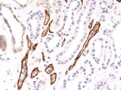 Immunohistochemistry-Paraffin: Complement C4b/d Antibody (C4D204) - Azide and BSA Free [NBP2-34581] - Formalin-fixed, paraffin-embedded human kidney transplant tissue (40X) stained with Complement 4d Ab (C4D204).