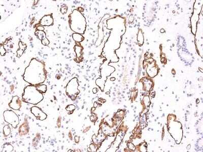 Immunohistochemistry-Paraffin: Complement C4b/d Antibody (C4D204) - IHC-Prediluted [NBP2-44791] - Formalin-fixed, paraffin-embedded human kidney transplant tissue (20X) stained with Complement 4d MAb (C4D204).