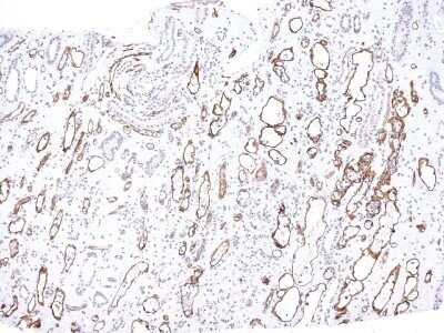 Immunohistochemistry-Paraffin: Complement C4b/d Antibody (C4D204) - IHC-Prediluted [NBP2-44791] - Formalin-fixed, paraffin-embedded human kidney transplant tissue (10X) stained with Complement 4d MAb (C4D204).