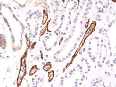 Immunohistochemistry-Paraffin: Complement C4b/d Antibody (SPM545) - Azide and BSA Free [NBP2-34421] - Formalin-fixed, paraffin-embedded kidney transplant tissue (40X) stained with Complement 4d Ab (SPM545).