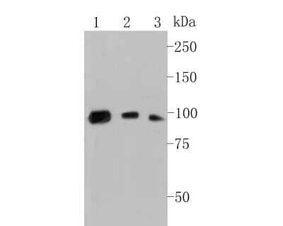 Western Blot: Complement C7 Antibody (15D1) [NBP2-80406] - Analysis of Complement Complement C7 on different lysates. Proteins were transferred to a PVDF membrane and blocked with 5% BSA in PBS for 1 hour at room temperature. The primary antibody (NBP2-80406, 1/500) was used in 5% BSA at room temperature for 2 hours. Goat Anti-Mouse IgG - HRP Secondary Antibody at 1:5,000 dilution was used for 1 hour at room temperature.Positive control: Lane 1: HepG2 cell lysateLane 2: K562 cell lysateLane 3: HUVEC cell lysate