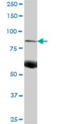 Western Blot: Complement C7 Antibody [H00000730-B01P] - Analysis of C7 expression in human stomach.
