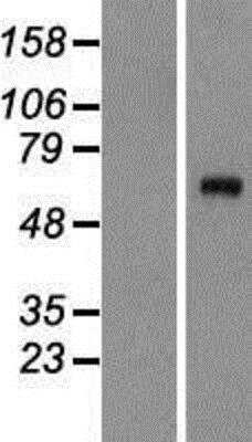 Western Blot: Complement C8A Overexpression Lysate (Native) [NBP2-09010] - Complement C8A Overexpression Lysate (Native) Left-Empty vector transfected control cell lysate (HEK293 cell lysate); Right -Over-expression Lysate for C8A.
