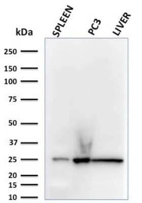 Western Blot: Complement Component C1qA Antibody (C1QA/2783) - Azide and BSA Free [NBP2-79915] - Western Blot Analysis of human spleen, PC3 and liver lysates using Complement Component C1qA Antibody (C1QA/2783).