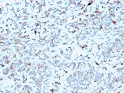 Immunohistochemistry-Paraffin: Complement Component C1qA Antibody (C1QA/2952) [NBP3-08746] - Formalin-fixed, paraffin-embedded human Kidney stained with Complement Component C1qA Mouse Monoclonal Antibody (Complement Component C1qA/2952).