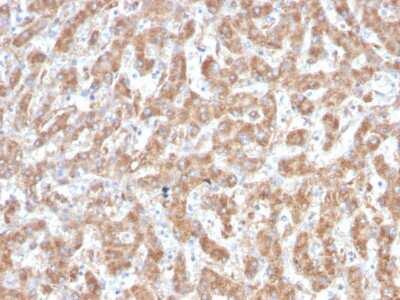 Immunohistochemistry-Paraffin: Complement Component C1qA Antibody (C1QA/2952) [NBP3-08746] - Formalin-fixed, paraffin-embedded human Liver stained with Complement Component C1qA Mouse Monoclonal Antibody (Complement Component C1qA/2952).