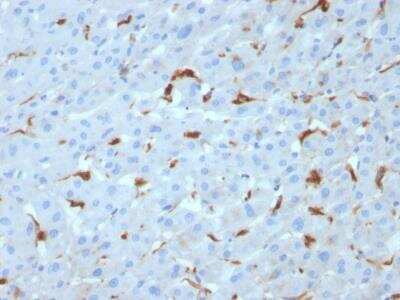 Immunohistochemistry-Paraffin: Complement Component C1qA Antibody (C1QA/2953) - Azide and BSA Free [NBP2-79916] - Formalin-fixed, paraffin-embedded human Liver stained with C1QA Mouse Monoclonal Antibody (C1QA/2953).