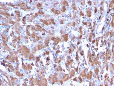 Immunohistochemistry-Paraffin: Complement Component C1qA Antibody (C1QA/2953) - Azide and BSA Free [NBP2-79916] - Formalin-fixed, paraffin-embedded human Liver stained with C1QA Mouse Monoclonal Antibody (C1QA/2953).