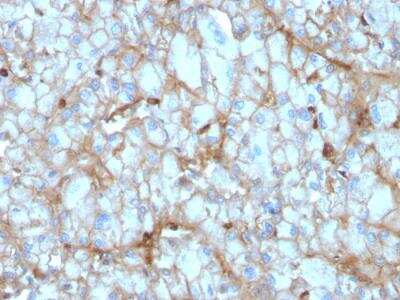 Immunohistochemistry-Paraffin: Complement Component C1qA Antibody (C1QA/2954) - Azide and BSA Free [NBP2-79919] - Formalin-fixed, paraffin-embedded human Kidney stained with C1QA Mouse Monoclonal Antibody (C1QA/2954).