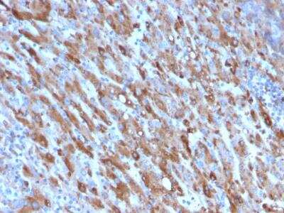 Immunohistochemistry-Paraffin: Complement Component C1qA Antibody (C1QA/2954) - Azide and BSA Free [NBP2-79919] - Formalin-fixed, paraffin-embedded human Liver stained with C1QA Mouse Monoclonal Antibody (C1QA/2954).