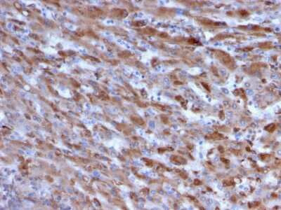 Immunohistochemistry-Paraffin: Complement Component C1qA Antibody (C1QA/2955) [NBP3-08748] - Formalin-fixed, paraffin-embedded human Liver stained with Complement Component C1qA Mouse Monoclonal Antibody (Complement Component C1qA/2955).